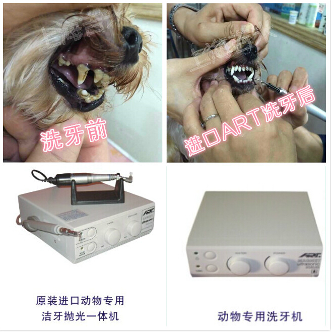 洗牙，潔牙